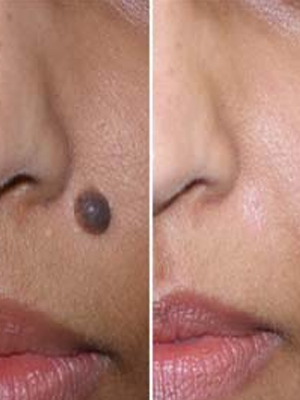 Midas Skin Clinic